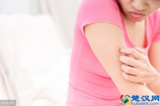  疥疮怎么治疗？3种方法，快速缓解