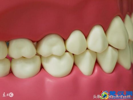  晚上睡觉磨牙是什么原因（磨牙不能忽视了这些疾病）