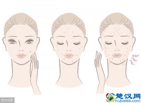  去痘价格（去除痘印的小妙招）