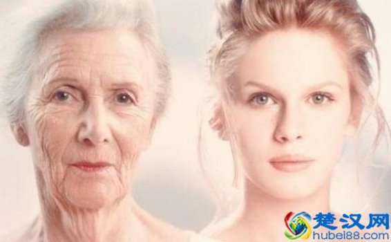  不失眠但多梦怎么办女性(多梦不失眠属于睡眠障碍吗)