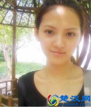  去黑眼圈眼袋小妙招勺子(勺子按摩法去眼袋)