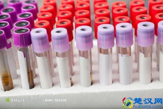  平均血小板体积偏高是什么意思，有哪些注意事项！