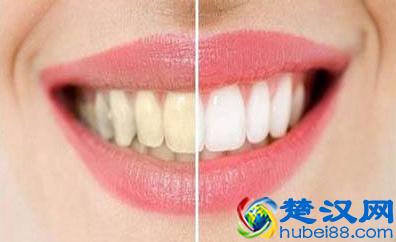  抽烟牙齿黄怎么变白？变白很简单，最省钱的方法