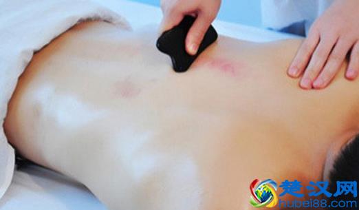  痉挛是什么意思（胃痉挛是什么症状）