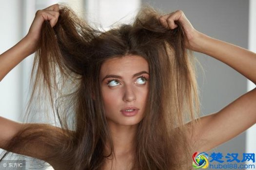  掉发严重是什么原因（防止掉发的几大方法）
