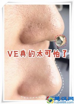  施尔美毛孔太大(草莓鼻如何去黑头)