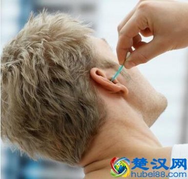  怎么掏耳朵正确方法（掏耳朵后耳鸣怎么办）