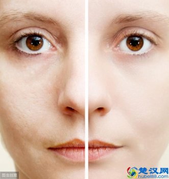  男生怎么清理毛孔垃圾（毛孔里都有什么垃圾）