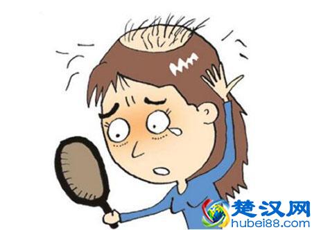  脱发严重怎么办（脱发越来越严重如何治疗）