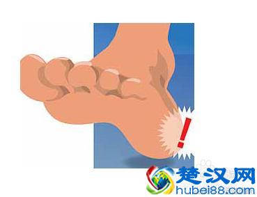  脚后跟麻是怎么回事,教你怎么缓解！