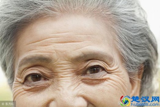  眼睛有皱纹怎么办？一招帮你缓解困扰