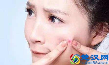  怎么去掉青春痘的疤痕疙瘩（疤痕疙瘩需要治疗吗）