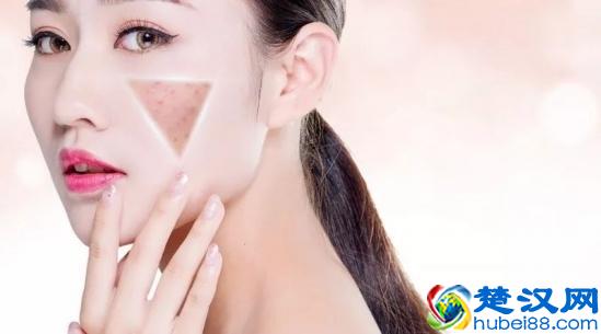  脸部毛孔大是什么原因引起的（毛孔粗大怎么修复）