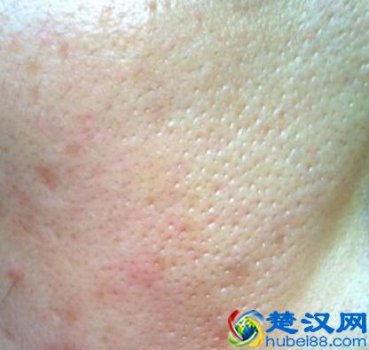  毛孔粗大用什么护肤品？缩小毛孔最有效的方法（护肤小窍门）