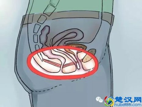  凯格尔运动正确做法（最全面的凯格尔运动教程）