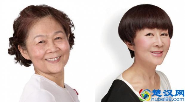  去除鱼尾纹多少钱（市场价）