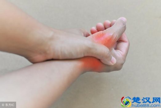  痛风发作时应如何缓解疼痛（这4个应对小方法或能帮你一把）