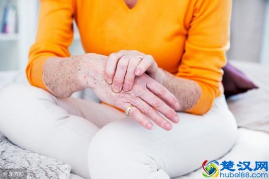  血沉是什么（血沉高是怎么回事？）