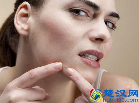  额头长痘什么原因引起（额头起痘痘的原因分析）