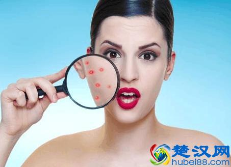 淡化红血丝的日常方法(脸上红血丝怎么调理)