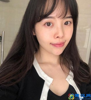  塌鼻子朝天鼻怎么办（富豪中有塌鼻梁的吗）