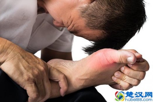  痛风症状的早期表现是怎么样！