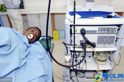  做胃镜多少钱，做胃镜前需要注意哪些！