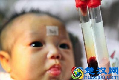  淋巴细胞百分比偏低是怎么回事，教你怎么调理！