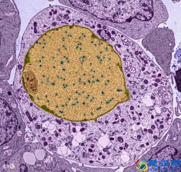  鼻癌的早期症状及表现有哪些！