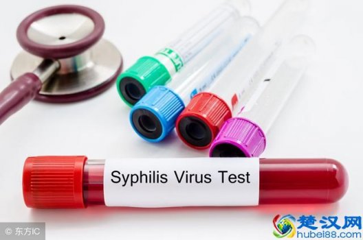  梅毒的早期症状有哪些，梅毒要注意哪些方面！