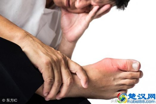  痛风不能吃什么东西，这些绝对不能吃！