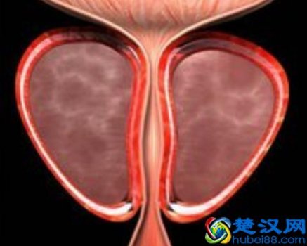  前列腺是什么引起的（治疗前列腺有哪些方案）