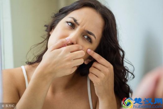  脸上长痤疮怎么办（长痤疮的原因你知道吗）