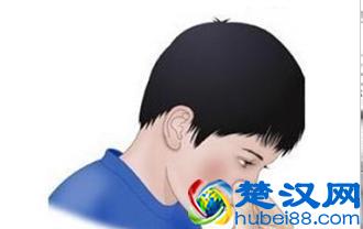  鼻子出血怎么止血（快速止血的好妙招）