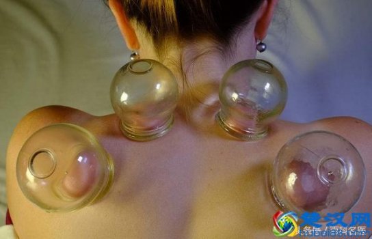  拔火罐有什么坏处（拔火罐的注意事项）
