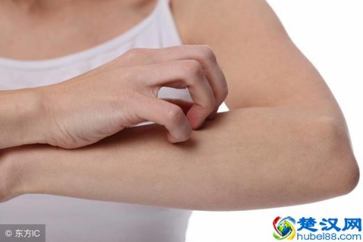  疖子是什么（多由金黄色葡萄球菌感染而成，不可轻视）