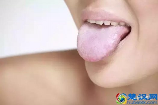  舌苔厚白是怎么回事（教你从舌苔中判断健康情况）