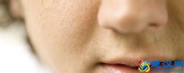  鼻子毛孔粗大怎么办（毛孔粗大原因及改善方法）