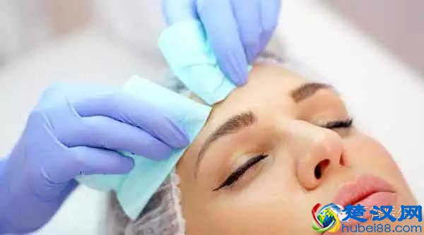  痘印怎么去除（教你几招轻松「摆平」）