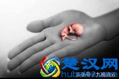  人流最佳时间是什么时候，人流需要注意的有哪些方面！