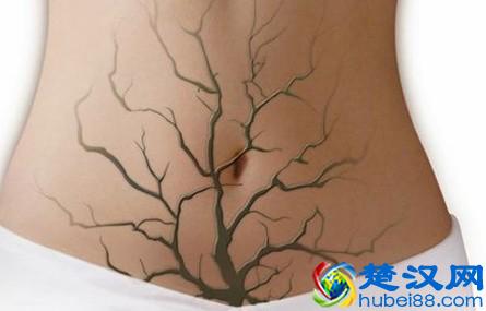  月经来了吃什么好排毒（经期饮食注意事项）