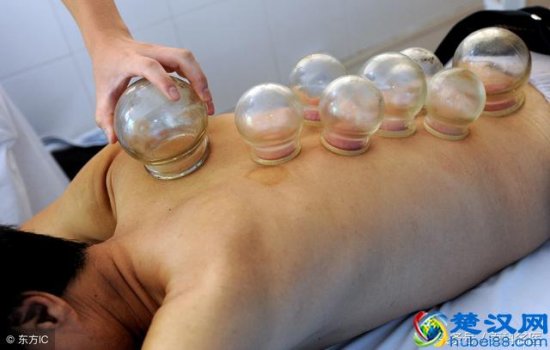  拔火罐有什么好处（拔火罐的原理是什么）