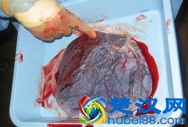  紫河车是什么的胎盘（紫河车有什么作用）