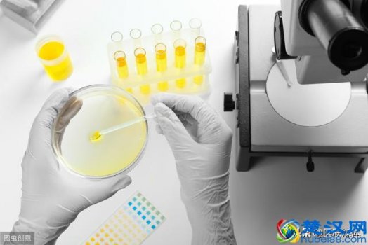  尿酸高吃什么食物好（尿酸高了不用慌，常吃这4种食物）