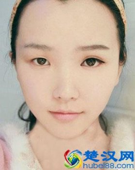  怎么样使眼睛变大？不手术变大眼睛的方法