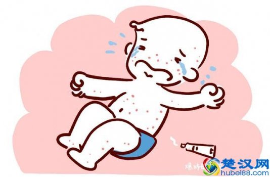  小孩秋天长湿疹是什么原因，宝妈们要注意这4点