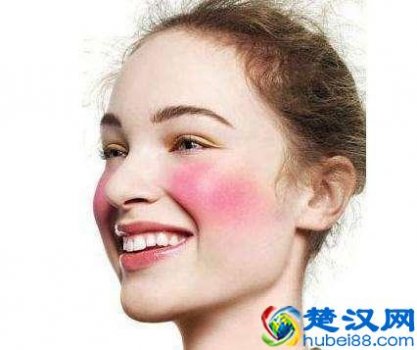  脸上有红血丝怎么去除？去除容易保养难