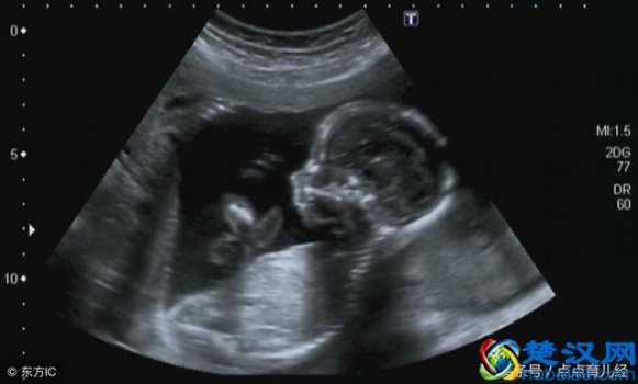 三维彩超检查哪些项目(三维彩超几周做合适)
