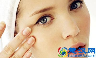  女朋友黑眼圈重怎么办（黑眼圈有遗传吗）