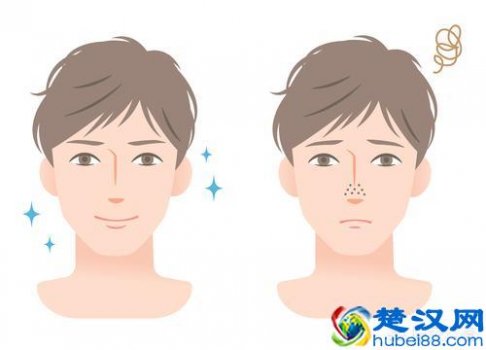  男士怎么样收缩毛孔（细化毛孔的护肤品）